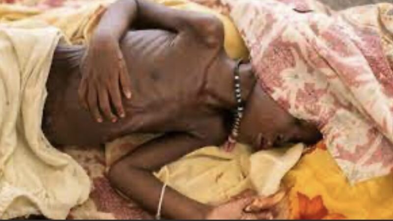 الكوليرا تستشري شرقي السودان ومنظمة الصحة العالمية تتحرك