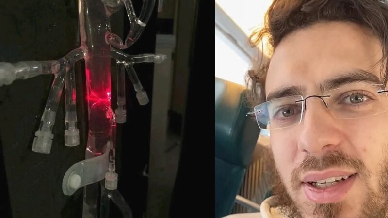 التفاصيل الكاملة لآخر خرجة للدكتور العزوزي مخترع جهاز تصفية الدم من داخل الاوعية الدموية بعد الهجوم الشرس عليه .